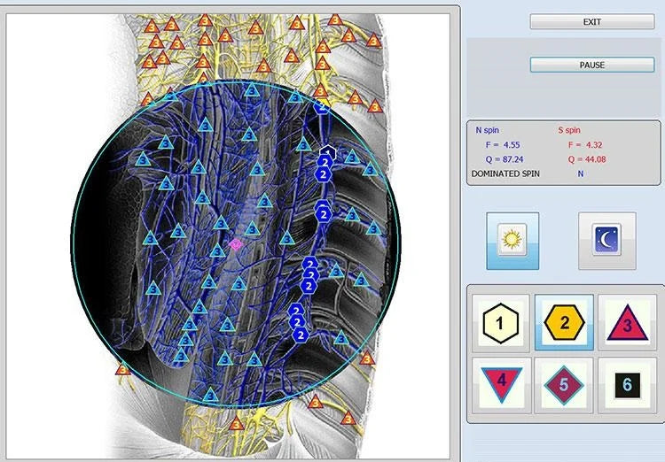 18D CELL NLS Aura Chakra Iris Health Scanner – Advanced Non-Linear Body Analyzer